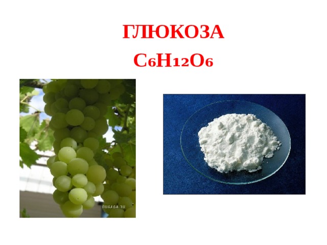 метаболический синдром